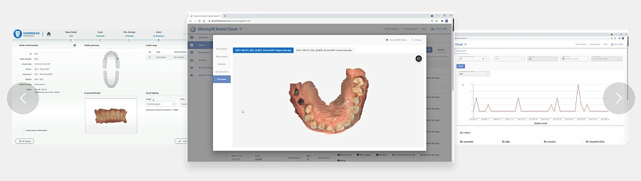 Интраоральный сканер Aoralscan L (LUX, полное ПО) - Фото 8